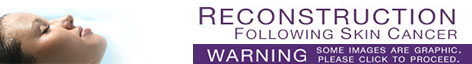 face reconstruction following skin cancer