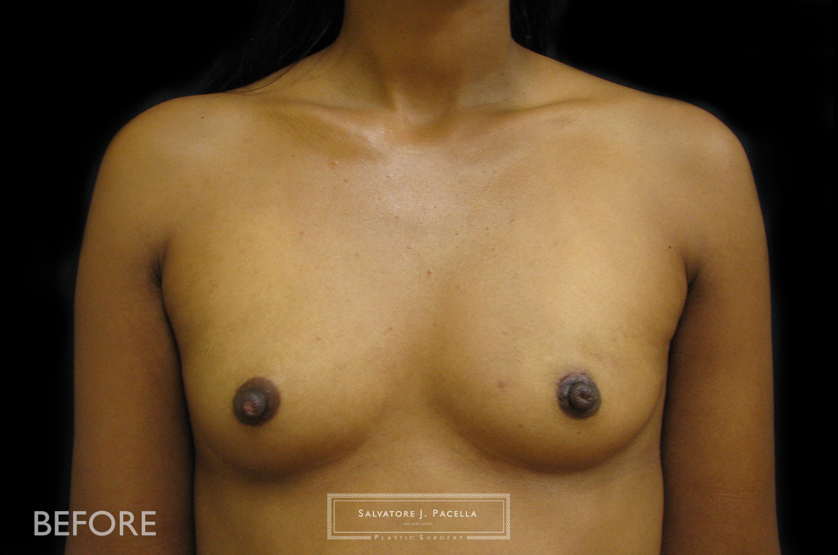 Before image
