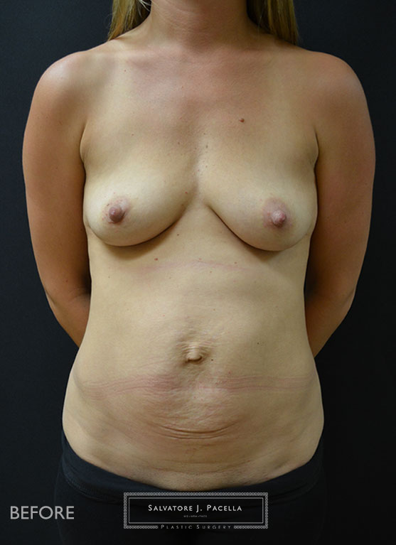 Before image