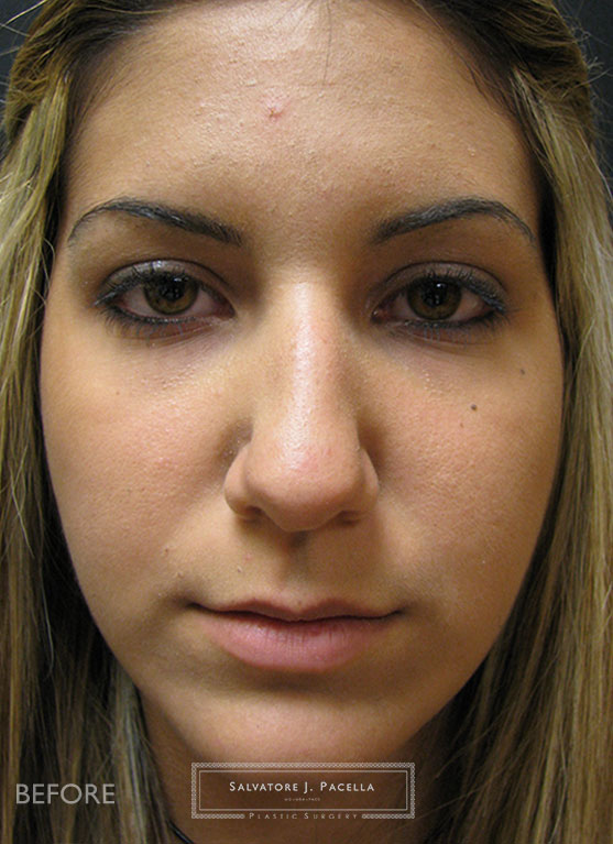 Before image