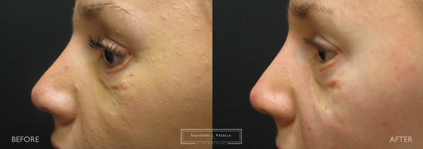 Eyelid expert | oculoplastic | ectropion | plastic surgery | Scripps plastic surgery | La Jolla | Carmel Valley | Del Mar | San Diego