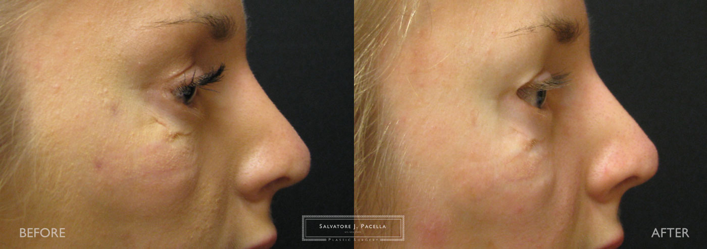 Eyelid expert | oculoplastic | ectropion | plastic surgery | Scripps plastic surgery | La Jolla | Carmel Valley | Del Mar | San Diego