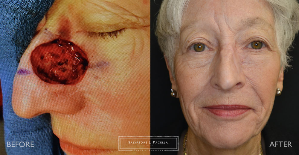 San Diego | La Jolla | Carmel Valley | Del Mar | Scripps Plastic Surgeon | Plastic Surgery | Nasal Expert | Nasal Surgery | Rhinoplasty | Mohs Surgery | Best Plastic Surgery