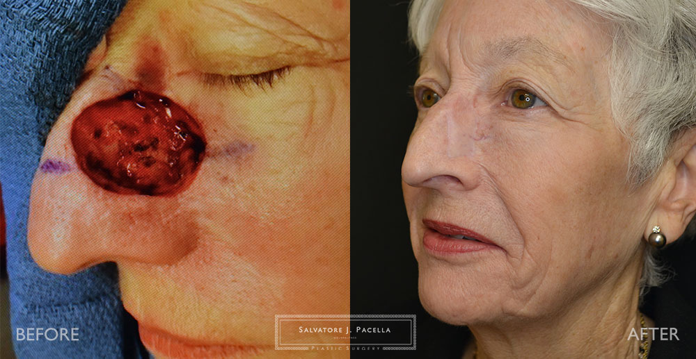 San Diego | La Jolla | Carmel Valley | Del Mar | Scripps Plastic Surgeon | Plastic Surgery | Nasal Expert | Nasal Surgery | Rhinoplasty | Mohs Surgery | Best Plastic Surgery