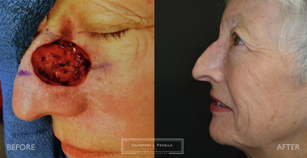 San Diego | La Jolla | Carmel Valley | Del Mar | Scripps Plastic Surgeon | Plastic Surgery | Nasal Expert | Nasal Surgery | Rhinoplasty | Mohs Surgery | Best Plastic Surgery
