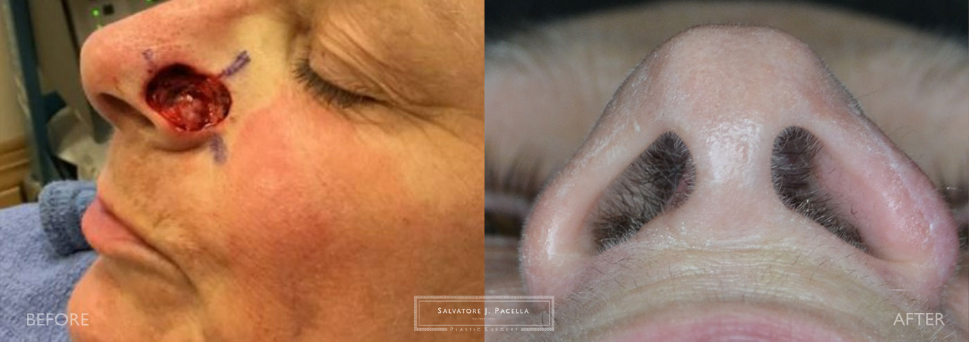 San Diego | La Jolla | Carmel Valley | Del Mar | Scripps Plastic Surgeon | Plastic Surgery | Nasal Expert | Nasal Surgery | Rhinoplasty | Mohs Surgery | Best Plastic Surgery